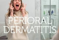 Natural Perioral Dermatitis Remedies Dermatologists Don’t Share